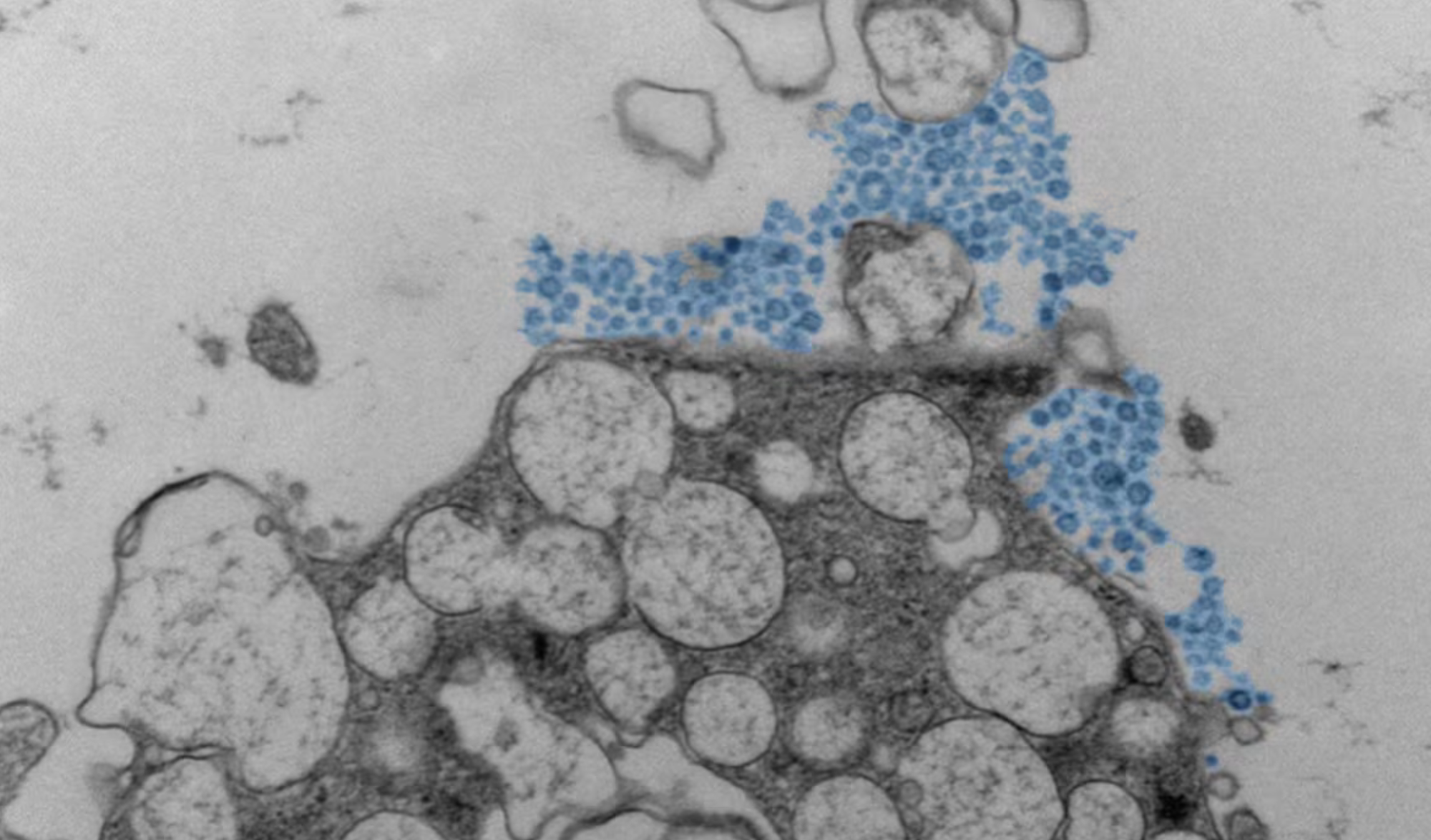 Lý do virus cảm lạnh ảnh hưởng mỗi người theo cách khác nhau- Ảnh 2.