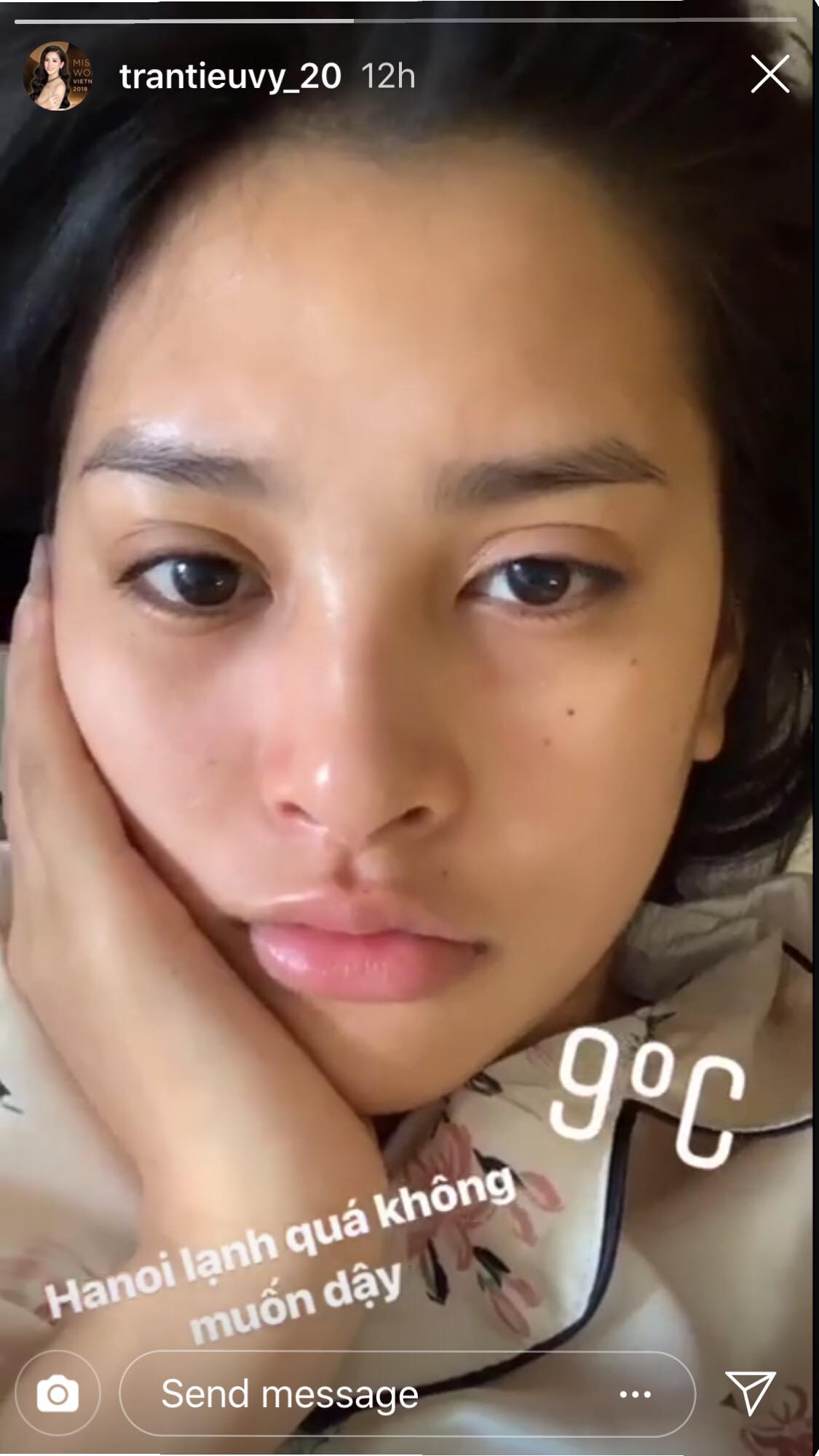 Mặt mộc của Tiểu Vy đẹp hơn cả khi trang điểm, duy nhất 1 khuyết điểm như người thường- Ảnh 9.