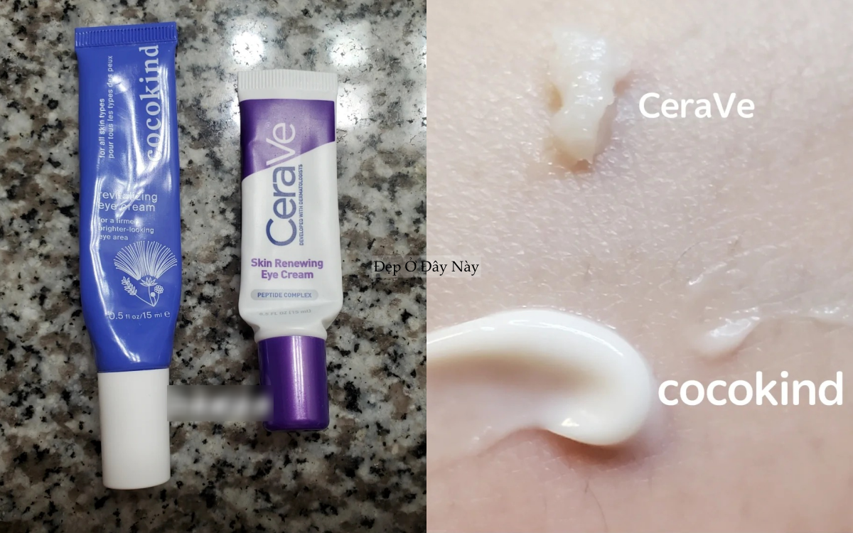 Ngo&agrave;i 30 tuổi t&ocirc;i nghiệm ra: Kem mắt b&igrave;nh d&acirc;n d&ugrave;ng đ&uacute;ng c&ograve;n hiệu quả hơn đồ đắt tiền- Ảnh 3.