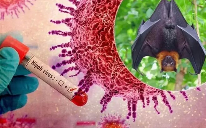 Bộ Y tế ban h&agrave;nh hướng dẫn chẩn đo&aacute;n v&agrave; điều trị bệnh do virus Nipah- Ảnh 1.