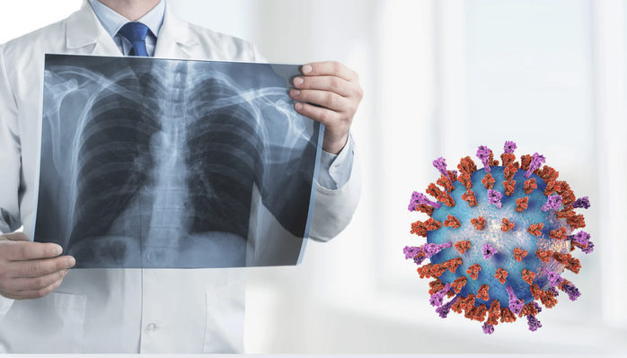 Vi&ecirc;m h&ocirc; hấp cấp r&igrave;nh rập ng&agrave;y Tết- Ảnh 1.