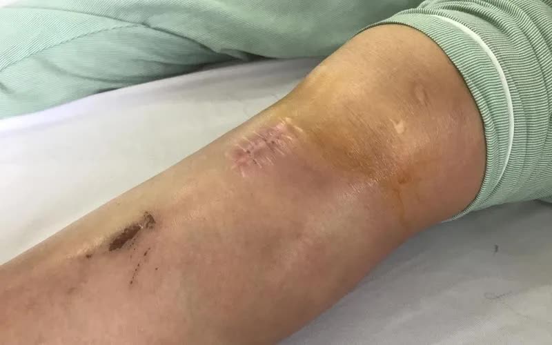 Dọn nh&agrave; đ&oacute;n Tết, ph&ograve;ng ngừa chấn thương khớp- Ảnh 1.