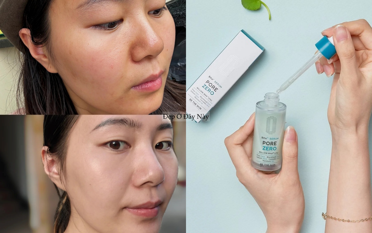 5 bước chăm da gi&uacute;p lỗ ch&acirc;n l&ocirc;ng to se kh&iacute;t, da mịn thấy r&otilde;- Ảnh 5.