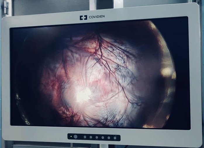 Giữ lại thiên chức làm mẹ cho bệnh nhân 22 tuổi- Ảnh 1. Giữ lại thiên chức làm mẹ cho bệnh nhân 22 tuổi- Ảnh 1.