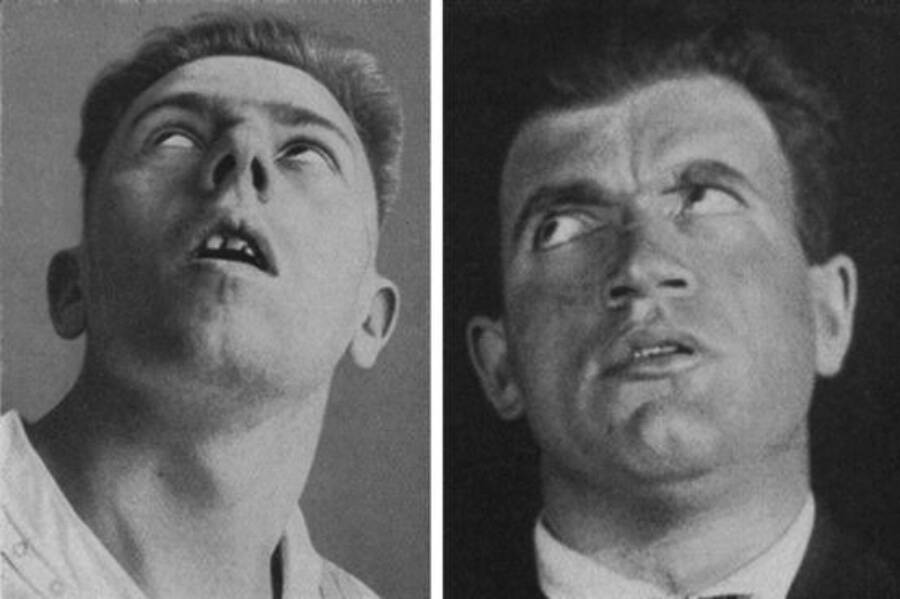 Căn bệnh kỳ lạ đ&atilde; giết chết 500.000 người rồi đột ngột biến mất- Ảnh 1.