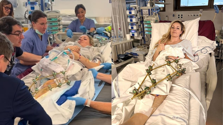 Huyền thoại trượt băng đối mặt nguy cơ cắt cụt ch&acirc;n sau tai nạn kinh ho&agrave;ng tại Olympic 2026- Ảnh 1.