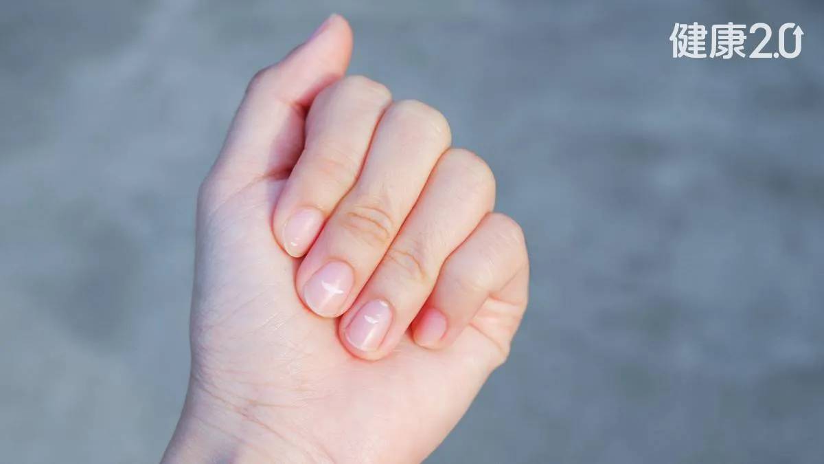 B&agrave;n tay l&agrave; t&iacute;n hiệu cảnh b&aacute;o sức khỏe: 1 thay đổi c&oacute; thể cho thấy bệnh tiểu đường hoặc xơ gan- Ảnh 1.
