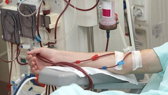 26 tuổi đã phải lọc máu cấp cứu: Bác sĩ cảnh báo 5 kiểu sống đang âm thầm hủy hoại thận của giới trẻ- Ảnh 2. 26 tuổi đã phải lọc máu cấp cứu: Bác sĩ cảnh báo 5 kiểu sống đang âm thầm hủy hoại thận của giới trẻ- Ảnh 2.