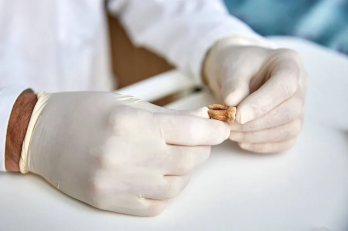 Giải mã từ "giáo sĩ phơi khô" đến đạo quân yểu mệnh của Napoleon- Ảnh 3. Giải mã từ "giáo sĩ phơi khô" đến đạo quân yểu mệnh của Napoleon- Ảnh 3.