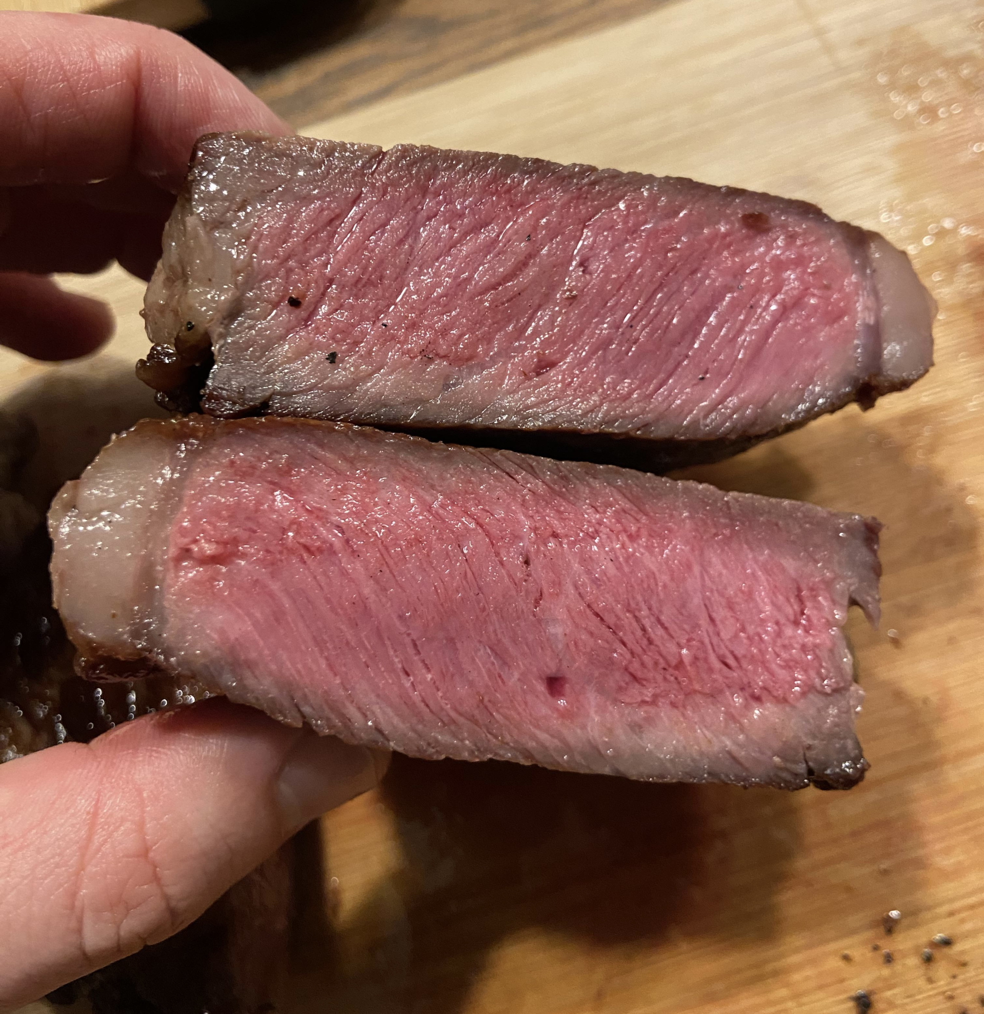 Một phụ nữ 32 tuổi thải ra sinh vật sống D&Agrave;I 3 M&Eacute;T, b&aacute;c sĩ chỉ đ&iacute;ch danh kiểu d&ugrave;ng thớt "g&acirc;y hoạ" nhưng cực quen- Ảnh 2.