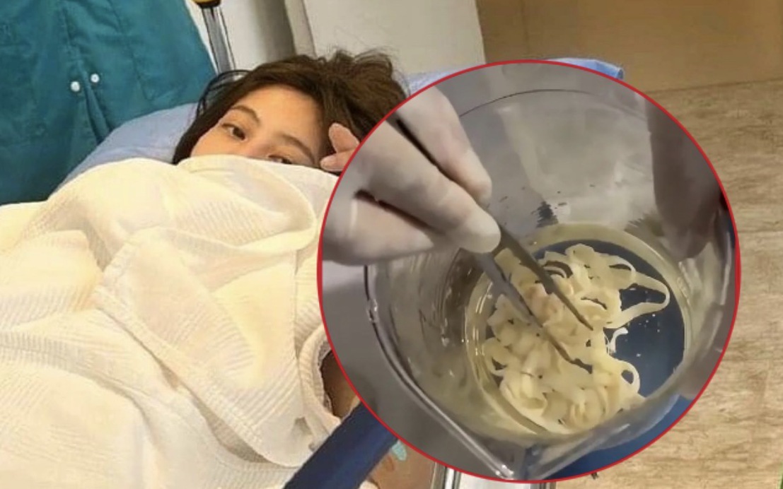 Một phụ nữ 32 tuổi thải ra sinh vật sống D&Agrave;I 3 M&Eacute;T, b&aacute;c sĩ chỉ đ&iacute;ch danh kiểu d&ugrave;ng thớt 