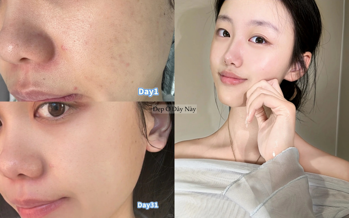 5 chi&ecirc;u "v&agrave;ng ngọc" khi d&ugrave;ng serum gi&uacute;p l&agrave;n da tuổi 25+ lu&ocirc;n khỏe đẹp- Ảnh 1.