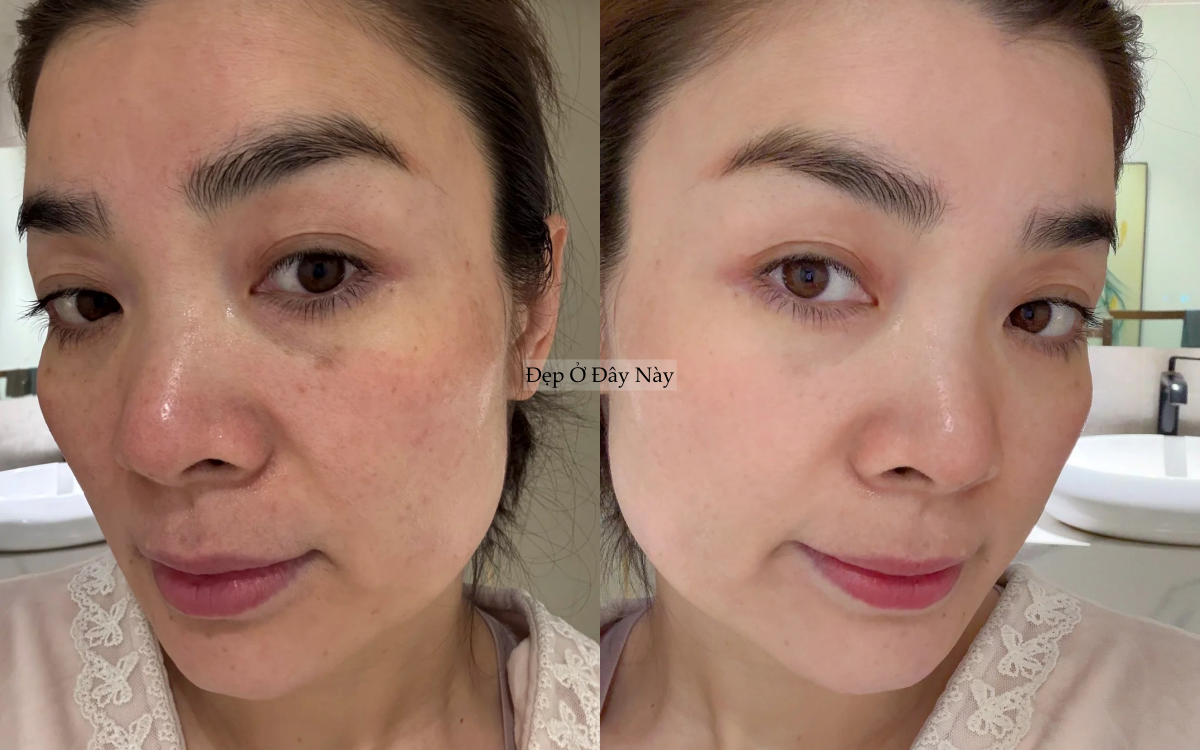 Ngo&agrave;i 40 tuổi, t&ocirc;i đ&atilde; t&igrave;m ra c&aacute;ch "cải l&atilde;o ho&agrave;n đồng", gi&uacute;p da từ tổn thương tới khỏe đẹp mịn căng- Ảnh 2.