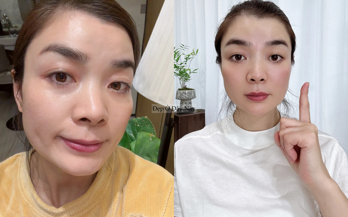 Ngo&agrave;i 40 tuổi, t&ocirc;i đ&atilde; t&igrave;m ra c&aacute;ch "cải l&atilde;o ho&agrave;n đồng", gi&uacute;p da từ tổn thương tới khỏe đẹp mịn căng- Ảnh 1.