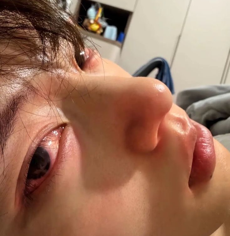 Nam shipper 26 tuổi suy thận nặng v&igrave; loại nước thơm ngọt "vạn người m&ecirc;", b&aacute;c sĩ n&oacute;i thẳng: 5 việc "ph&aacute; thận" hơn uống rượu- Ảnh 3.