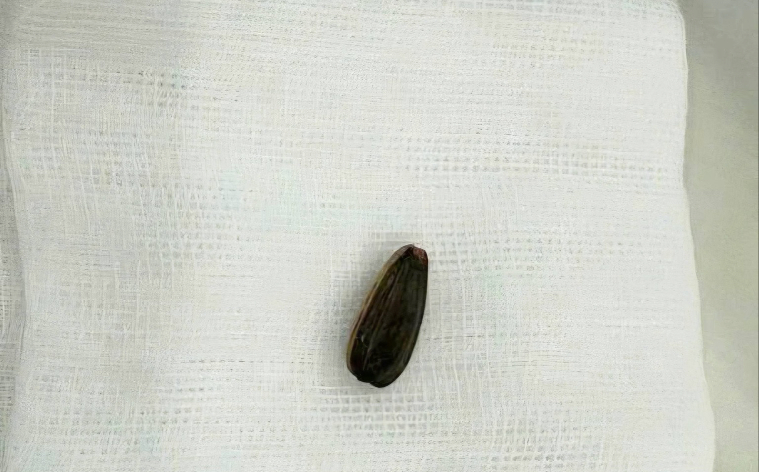 B&eacute; 3 tuổi nguy kịch v&igrave; loại hạt thường c&oacute; tr&ecirc;n b&agrave;n tiếp kh&aacute;ch dịp Tết- Ảnh 3.