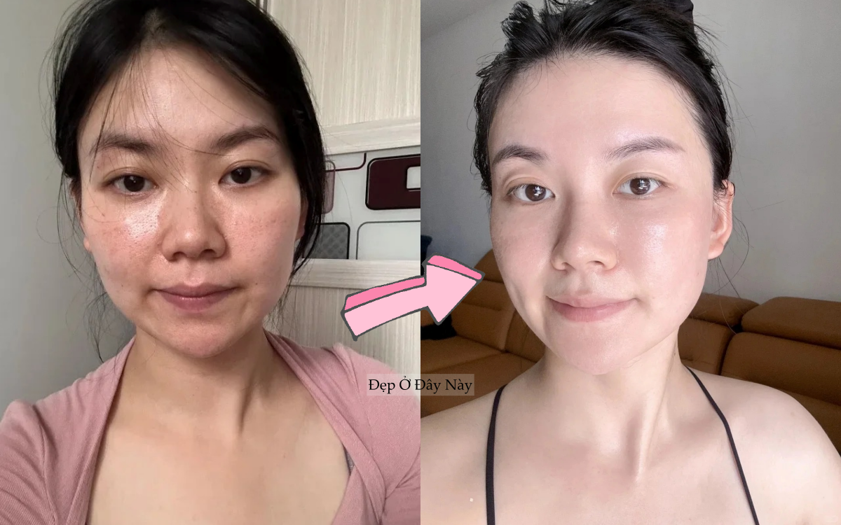 Kh&ocirc;ng cần mỹ phẩm đắt tiền, đ&acirc;y l&agrave; c&aacute;ch c&ocirc; n&agrave;ng ngo&agrave;i 30 tuổi giữ da trẻ l&acirc;u- Ảnh 1.