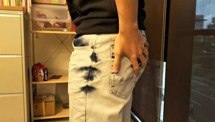 Nam t&agrave;i xế taxi thường xuy&ecirc;n x&igrave; hơi khi chở kh&aacute;ch, đi kh&aacute;m mới lộ ra KHỐI U KHỔNG LỒ đang "bức tử" nhiều cơ quan- Ảnh 3.