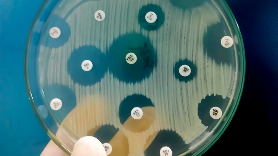 Một thứ b&iacute; ẩn bị "phong ấn" trong hang băng 5.000 năm vừa được giải ph&oacute;ng, c&oacute; thể tạo ra ph&eacute;p m&agrave;u cho nh&acirc;n loại- Ảnh 2.