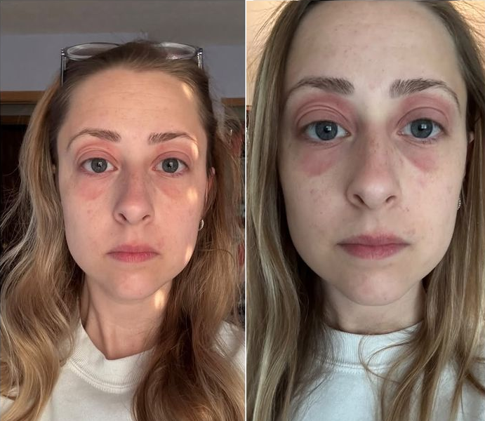 Bỏ 10 tỷ mua nhà, dọn vào ở được vài tháng, người phụ nữ mắc phải căn bệnh lạ khiến cơ thể biến dạng- Ảnh 1. Bỏ 10 tỷ mua nhà, dọn vào ở được vài tháng, người phụ nữ mắc phải căn bệnh lạ khiến cơ thể biến dạng- Ảnh 1.