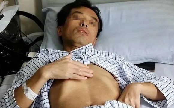 Người đ&agrave;n &ocirc;ng mắc ung thư gan v&igrave; ng&agrave;y n&agrave;o cũng uống nước từ loại cốc nhiều người d&ugrave;ng mỗi ng&agrave;y