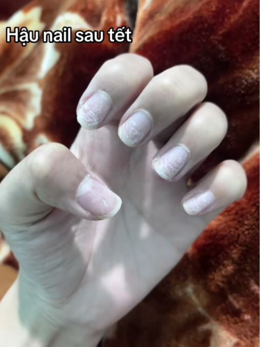 Cảnh tượng h&atilde;i h&ugrave;ng của những bộ nail sau Tết- Ảnh 4.