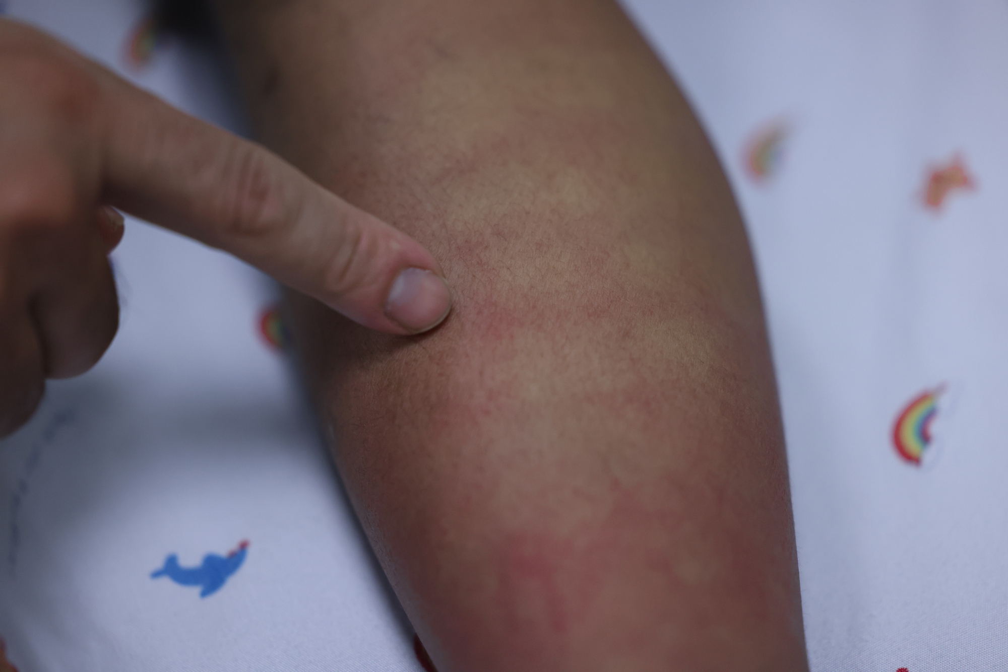 Một dịch bệnh b&aacute;o động đỏ sau Tết- Ảnh 4.