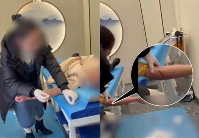 Bắt nh&oacute;m b&aacute;c sĩ giả chữa bệnh bằng phương ph&aacute;p tr&iacute;ch m&aacute;u thải độc, loại bỏ "t&agrave; kh&iacute;"- Ảnh 1.