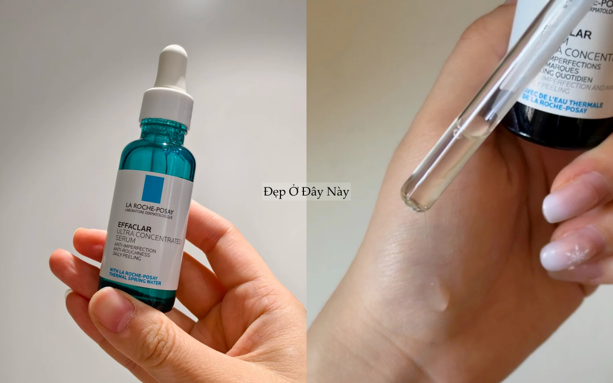 Lỗ ch&acirc;n l&ocirc;ng kh&ocirc;ng biến mất, nhưng t&ocirc;i đ&atilde; khiến ch&uacute;ng "nhỏ lại" thấy r&otilde; nhờ đ&uacute;ng 2 thứ- Ảnh 2.