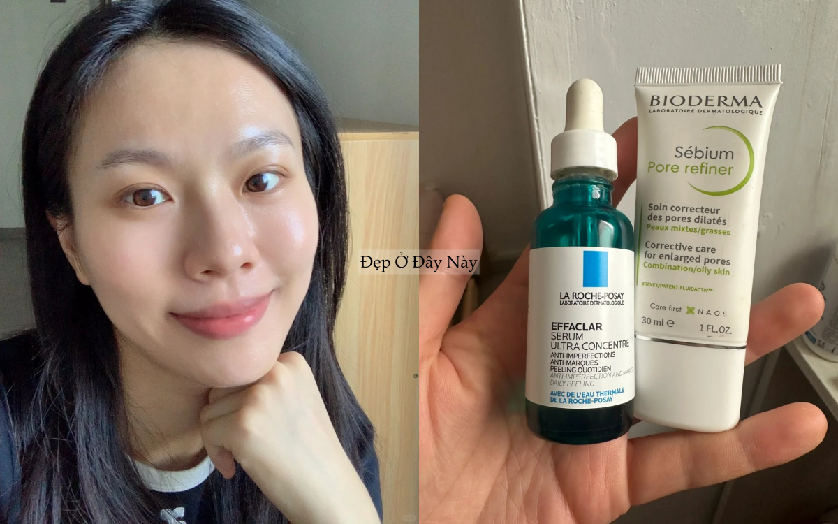 Lỗ ch&acirc;n l&ocirc;ng kh&ocirc;ng biến mất, nhưng t&ocirc;i đ&atilde; khiến ch&uacute;ng "nhỏ lại" thấy r&otilde; nhờ đ&uacute;ng 2 thứ- Ảnh 4.