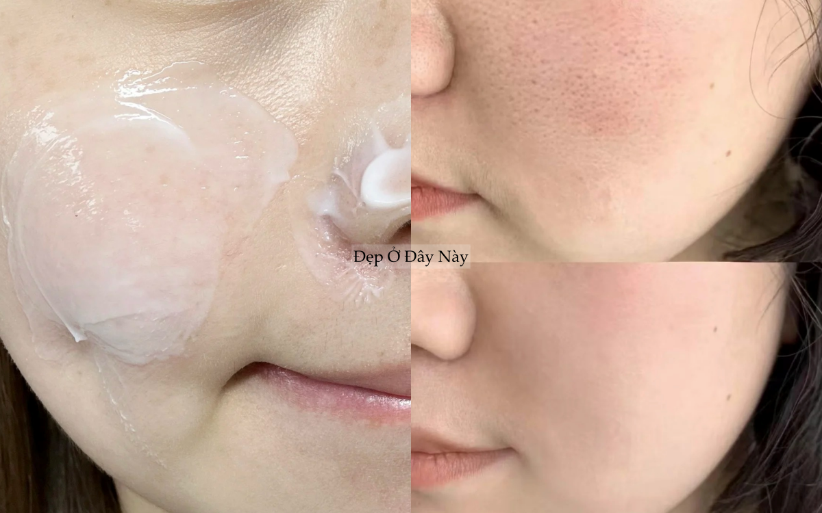 Lỗ ch&acirc;n l&ocirc;ng kh&ocirc;ng biến mất, nhưng t&ocirc;i đ&atilde; khiến ch&uacute;ng "nhỏ lại" thấy r&otilde; nhờ đ&uacute;ng 2 thứ- Ảnh 5.