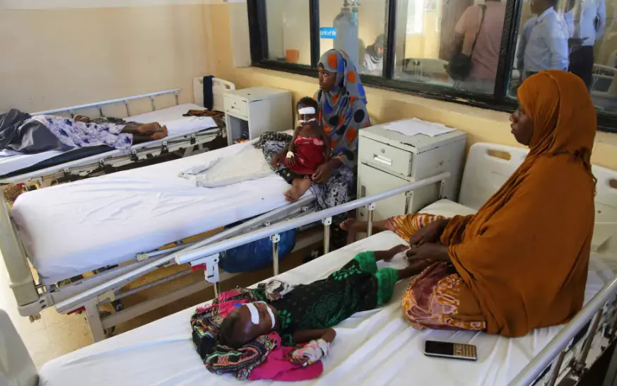 Trẻ bị suy dinh dưỡng tại Bệnh viện Banadir ở Mogadishu, Somalia, ng&agrave;y 14/5/2025 (Ảnh: AP)