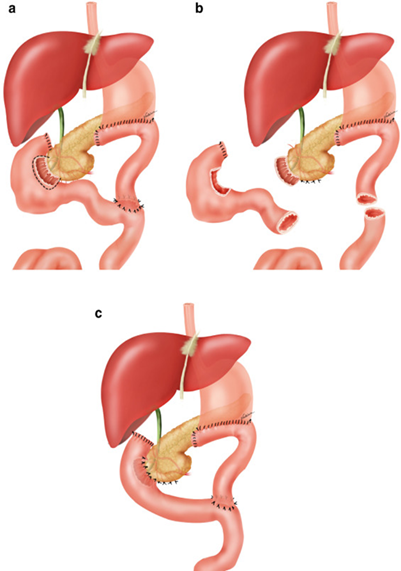 Lần đầu tại Việt Nam: B&aacute;c sĩ phẫu thuật th&agrave;nh c&ocirc;ng cho bệnh nh&acirc;n nước ngo&agrave;i mắc bệnh si&ecirc;u hiếm, 7 năm ''ăn v&agrave;o l&agrave; n&ocirc;n ra''- Ảnh 2.