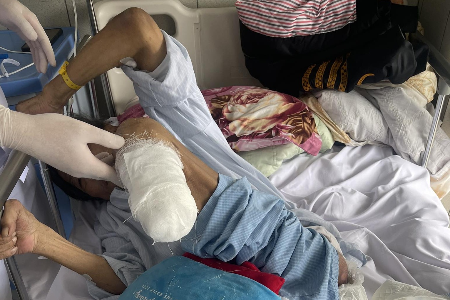 Người đàn ông hoại tử chân, viêm loét triền miên ở tuổi 62: Bác sĩ chỉ rõ 4 “thủ phạm” phá hủy mạch máu- Ảnh 1. Người đàn ông hoại tử chân, viêm loét triền miên ở tuổi 62: Bác sĩ chỉ rõ 4 “thủ phạm” phá hủy mạch máu- Ảnh 1.