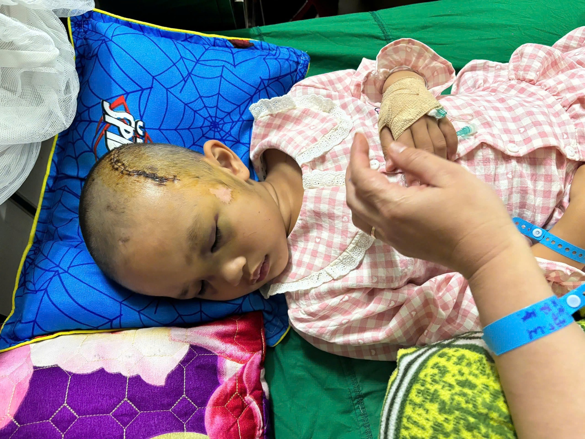 B&eacute; g&aacute;i 6 tuổi nguy kịch sau khi ng&atilde; từ tầng 2 ng&agrave;y m&ugrave;ng 2 Tết, gia đ&igrave;nh ngh&egrave;o kiệt quệ cầu cứu- Ảnh 3.