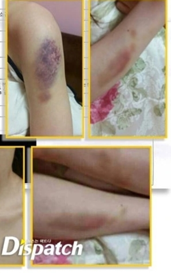 B&iacute; mật động trời của Kim Hyun Joong (Vườn Sao Băng) sau 11 năm mới được c&ocirc;ng bố- Ảnh 2.