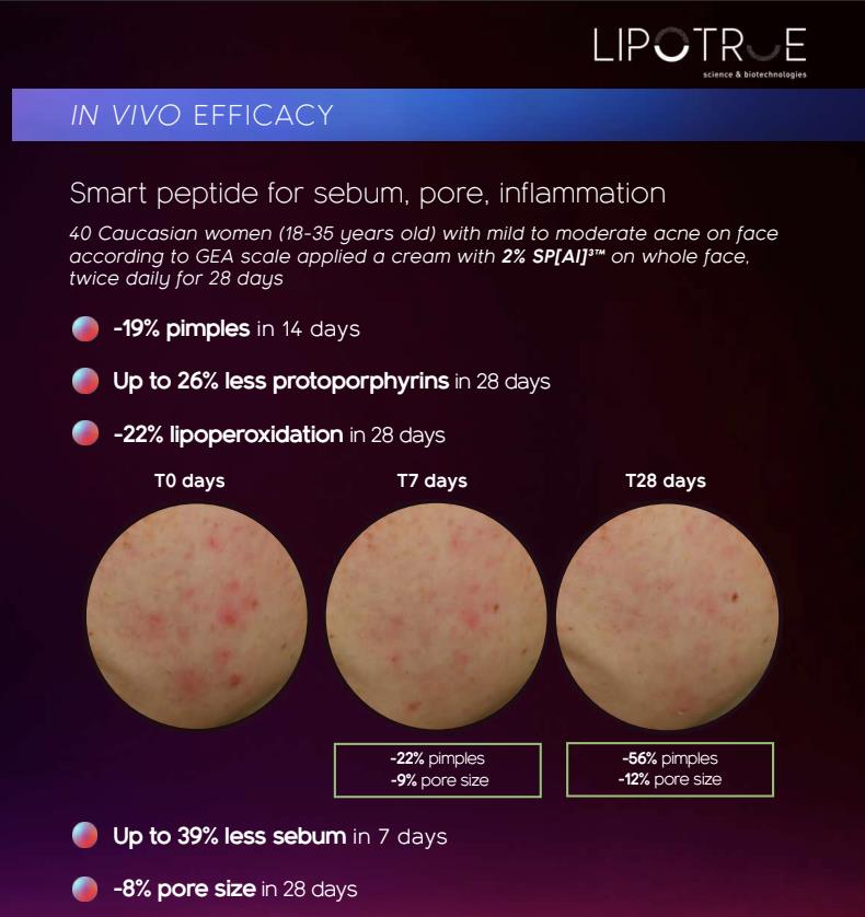 Inolab Derma ra mắt kem mụn kh&ocirc;ng acid: Giải ph&aacute;p hiệu quả cho l&agrave;n da mụn nhạy cảm- Ảnh 3.