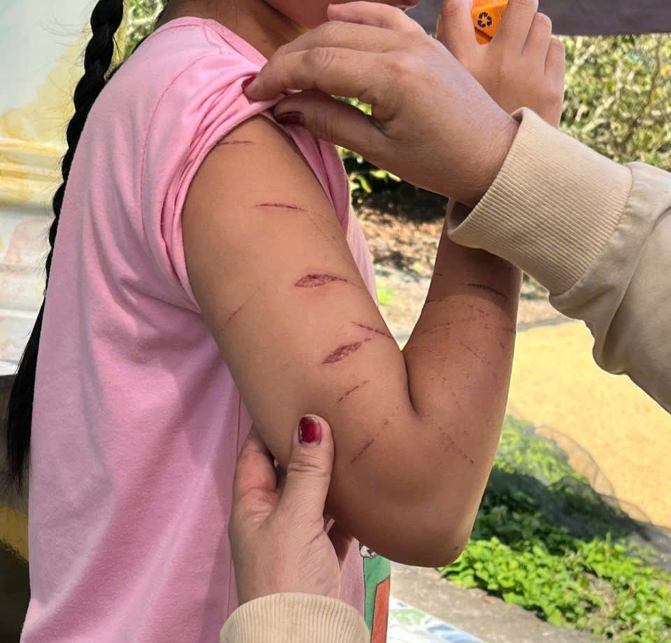 Nữ sinh lớp 5 ở Cà Mau bị người thân dùng dao cắt giấy gây thương tích- Ảnh 1. Nữ sinh lớp 5 ở Cà Mau bị người thân dùng dao cắt giấy gây thương tích- Ảnh 1.