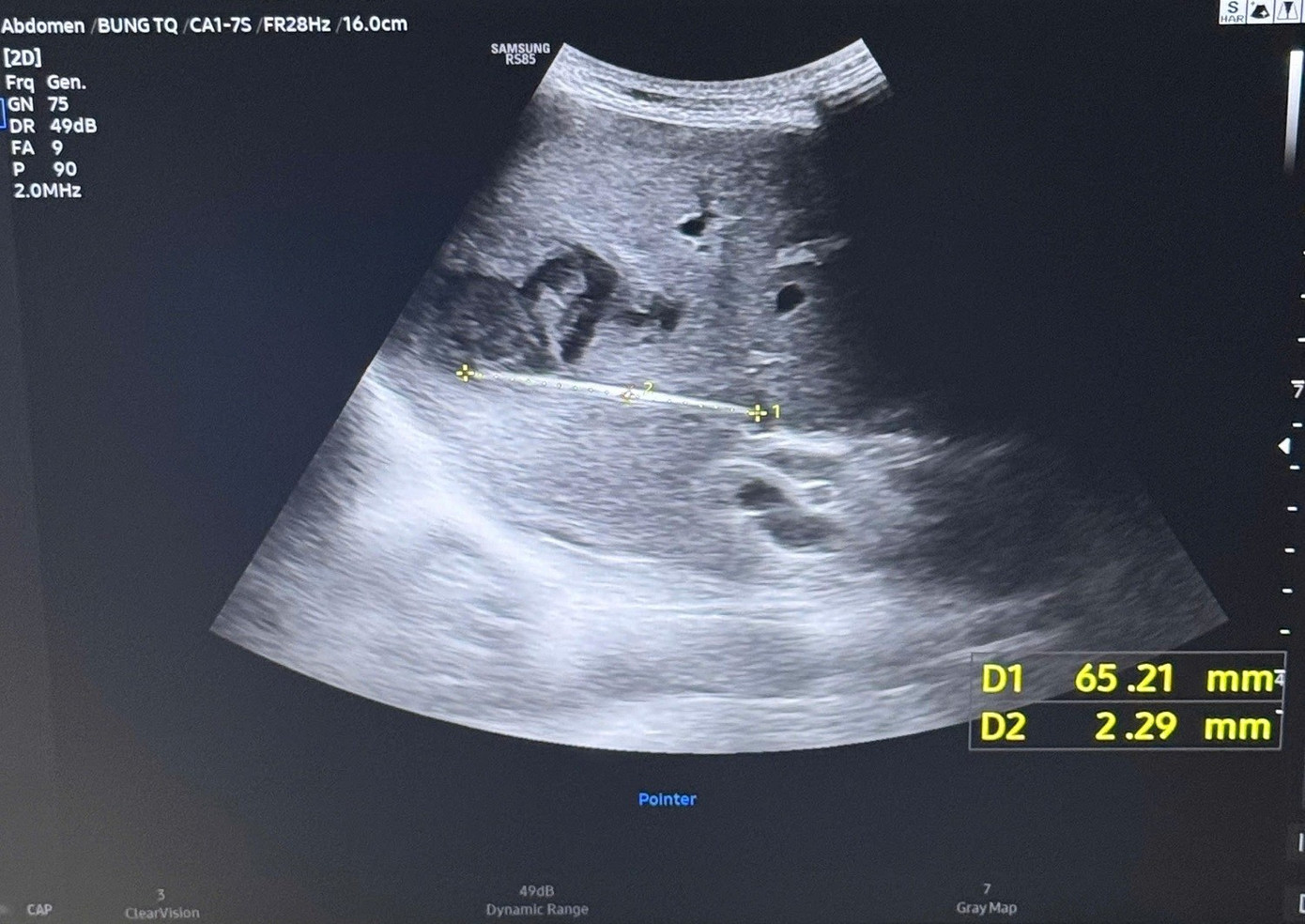 Nguy kịch t&iacute;nh mạng v&igrave; th&oacute;i quen phổ biến sau bữa ăn của người Việt- Ảnh 1.