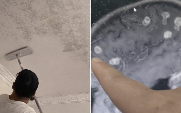 B&eacute; g&aacute;i 6 tuổi bị 