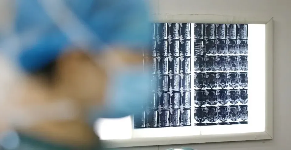 5 loại vi&ecirc;m tưởng nhẹ  thực chất l&agrave; "chu&ocirc;ng b&aacute;o ung thư": C&agrave;ng dập sớm, rủi ro c&agrave;ng thấp- Ảnh 1.