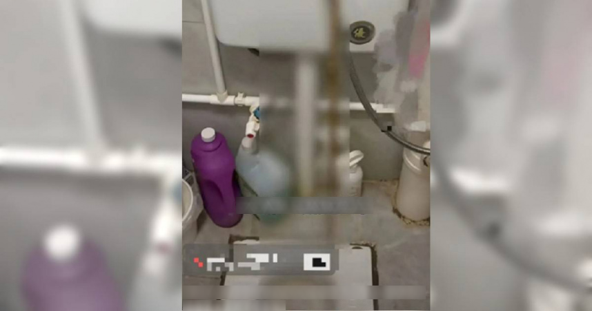 Người phụ nữ 32 tuổi đi ngo&agrave;i ra s&aacute;n d&agrave;i tới 3 m&eacute;t d&ugrave; chưa từng ăn đồ sống, b&aacute;c sĩ chỉ ra 1 thứ bếp nh&agrave; n&agrave;o cũng c&oacute; ch&iacute;nh l&agrave; thủ phạm- Ảnh 1.