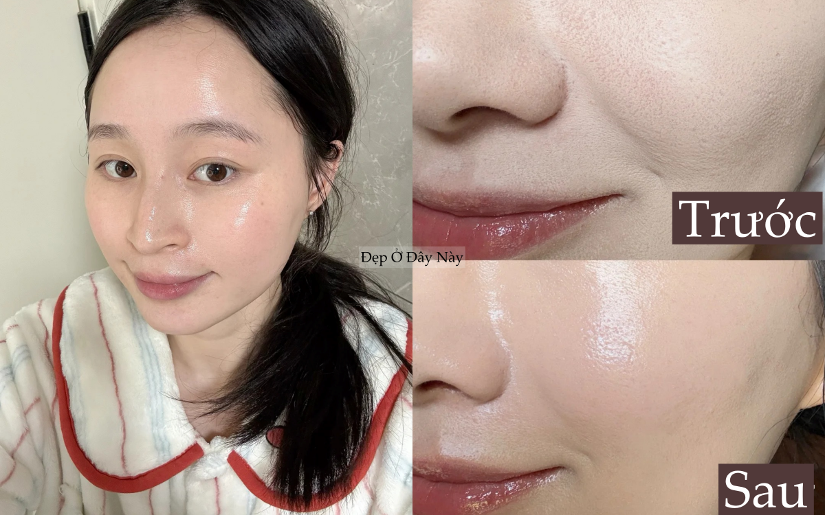 T&ocirc;i đ&atilde; c&oacute; l&agrave;n da căng b&oacute;ng như đi spa chỉ sau khi th&ecirc;m đ&uacute;ng 1 bước serum n&agrave;y- Ảnh 1.