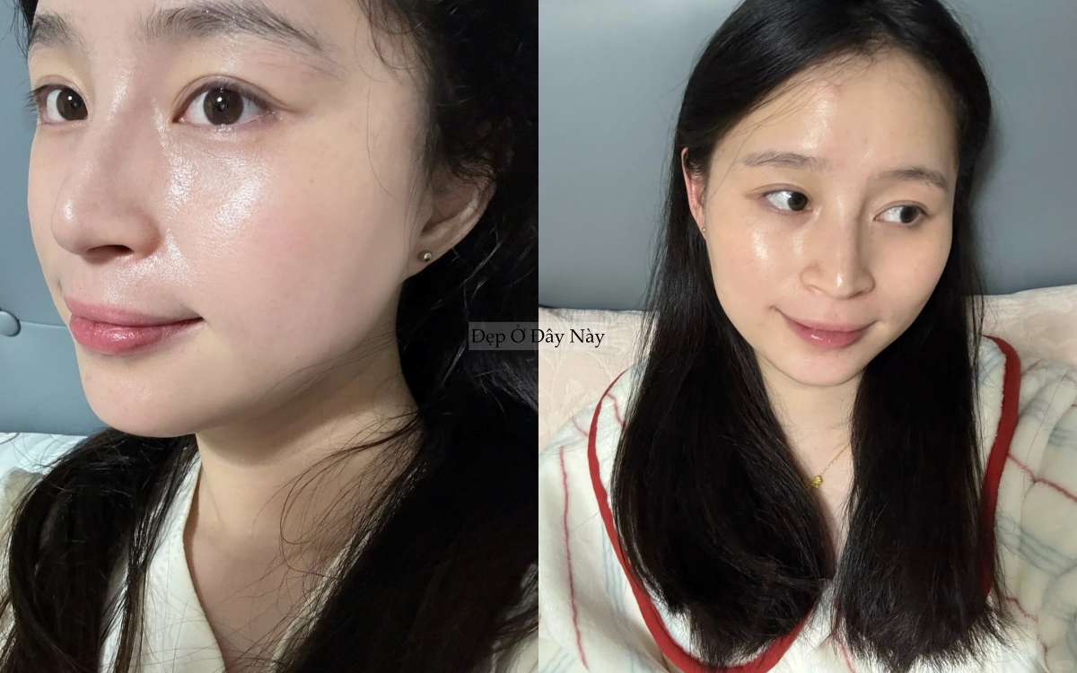 T&ocirc;i đ&atilde; c&oacute; l&agrave;n da căng b&oacute;ng như đi spa chỉ sau khi th&ecirc;m đ&uacute;ng 1 bước serum n&agrave;y- Ảnh 2.