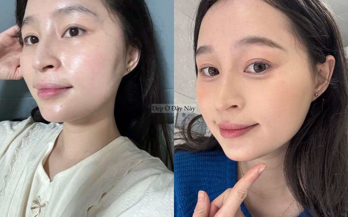 T&ocirc;i đ&atilde; c&oacute; l&agrave;n da căng b&oacute;ng như đi spa chỉ sau khi th&ecirc;m đ&uacute;ng 1 bước serum n&agrave;y- Ảnh 3.