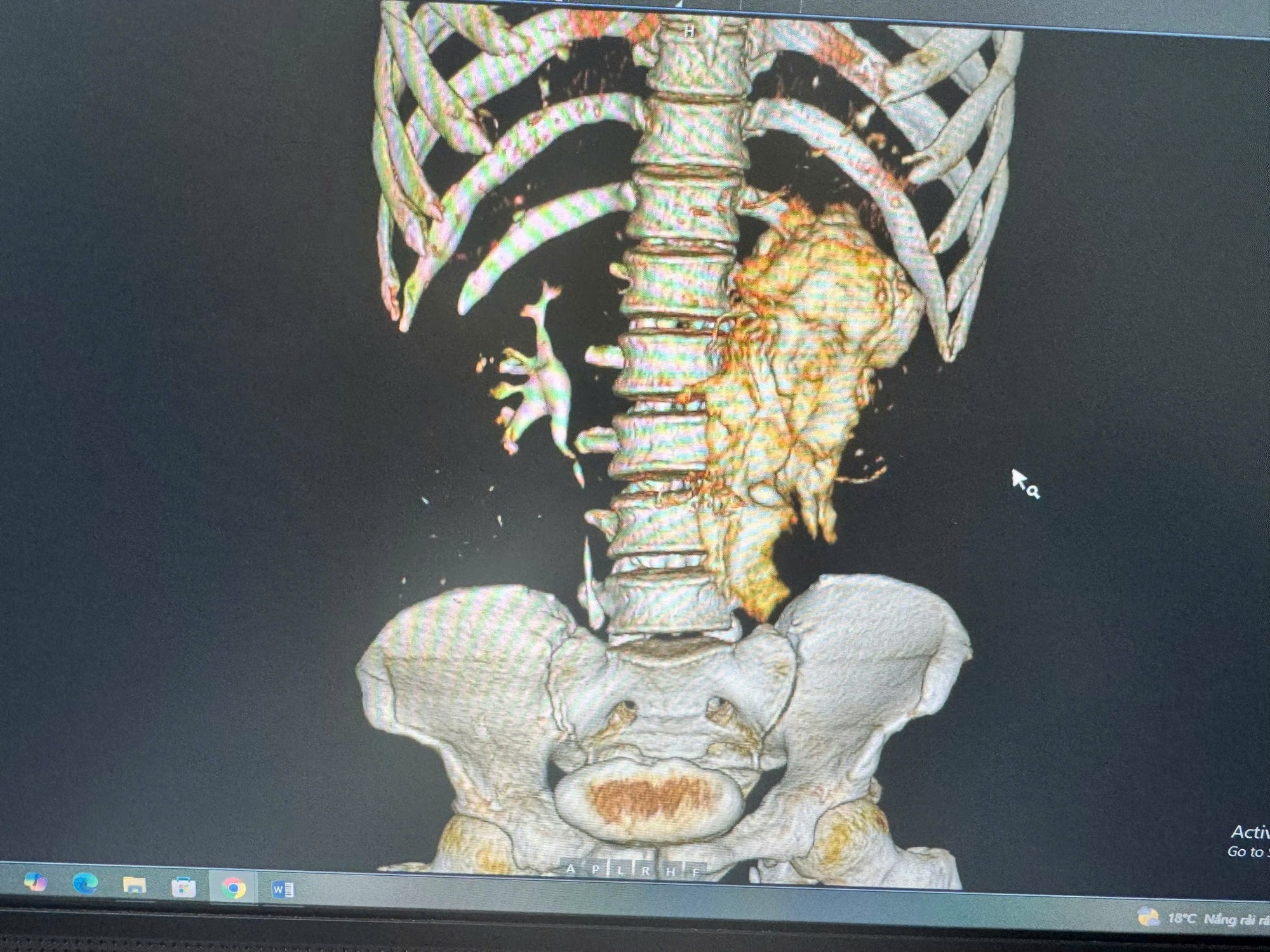"B&aacute;c sĩ ơi cứu em, nhưng... cho em về ăn Tết xong mổ được kh&ocirc;ng": Lời cầu khẩn khiến b&aacute;c sĩ khoa Thận-Tiết niệu v&agrave; Nam học lặng người trước thềm năm mới- Ảnh 3.