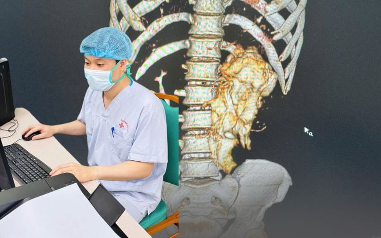 "B&aacute;c sĩ ơi cứu em, nhưng... cho em về ăn Tết xong mổ được kh&ocirc;ng": Lời cầu khẩn khiến b&aacute;c sĩ khoa Thận-Tiết niệu v&agrave; Nam học lặng người trước thềm năm mới- Ảnh 1.