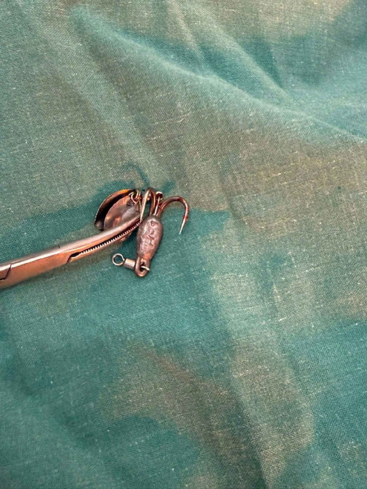 B&eacute; trai 13 tuổi chảy m&aacute;u nhiều, b&aacute;c sĩ sốc khi ph&aacute;t hiện b&iacute; mật "đ&aacute;ng sợ" ở cổ- Ảnh 1.