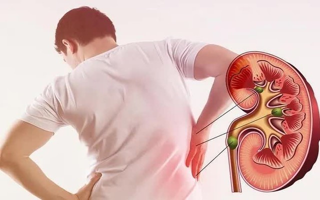 "Cầm dao mổ rồi mới thấy, nhiều quả thận ra đi m&atilde;i oan uổng chỉ v&igrave; thiếu hiểu biết": 30 cảnh b&aacute;o từ BS ph&ograve;ng mổ, ai cũng phải đọc- Ảnh 1.