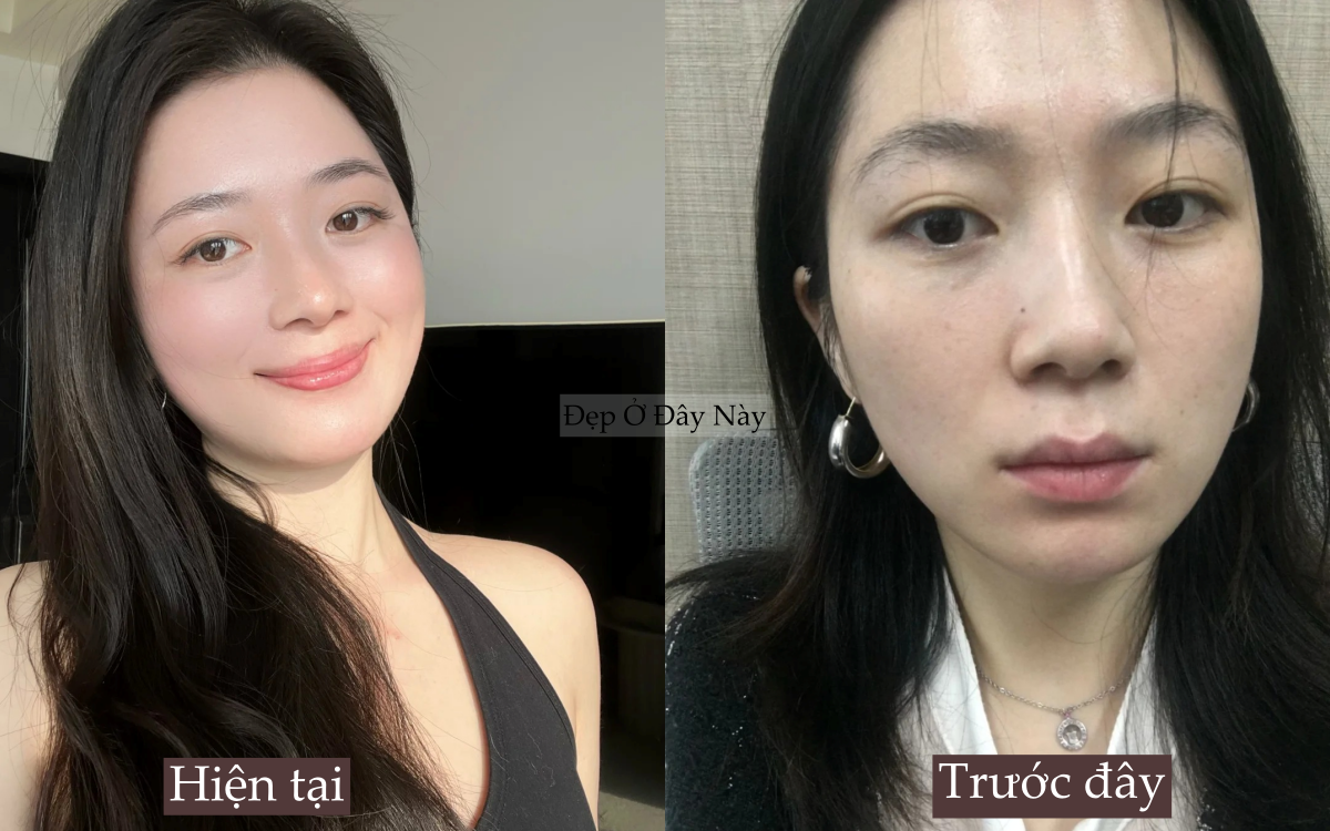 Ngo&agrave;i 30 da c&ograve;n đẹp hơn tuổi 20, t&ocirc;i l&agrave;m đ&uacute;ng 5 điều n&agrave;y mỗi ng&agrave;y để "l&atilde;o h&oacute;a ngược"- Ảnh 2.